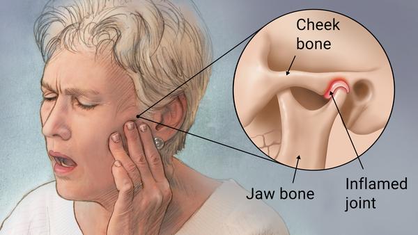 Jaw Pain - Dr7 Physiotherapy Podiatry Hydrotherapy Massage