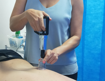 Dr7 Physiotherapist Katie using the cupping technique.