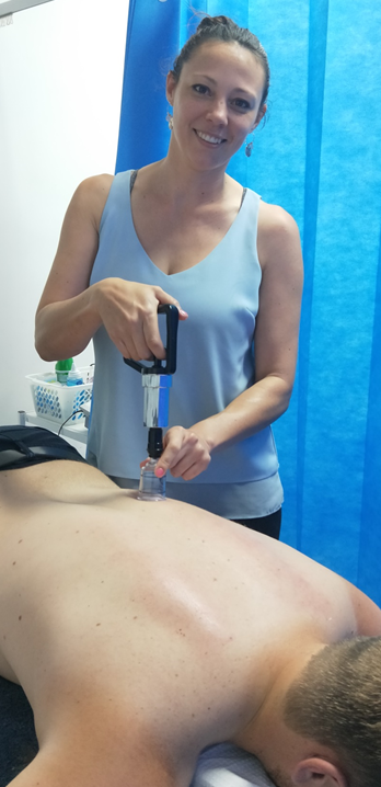 Dr7 Physiotherapist Katie using the cupping technique.